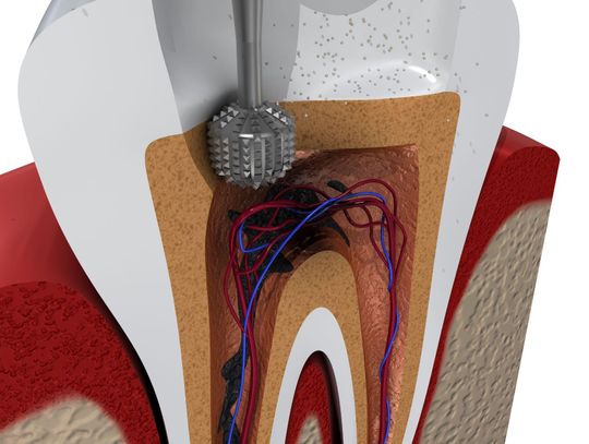Czy wiesz, co oznacza ból zęba? Sygnały, których nie wolno ignorować – Dental Arts Studio