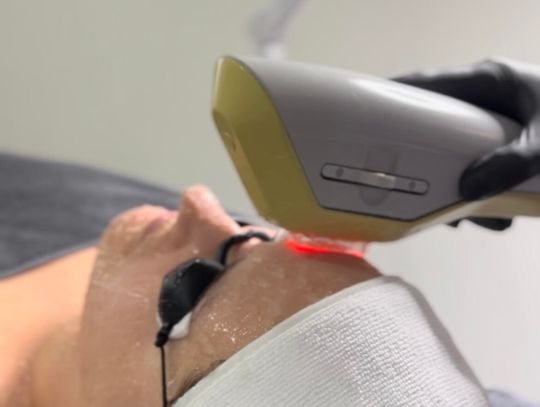 Usuwanie przebarwień - jakie zabiegi wybrać?